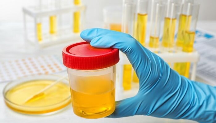Mulai 2026, Seluruh Aparatur Desa Wajib Tes Urine! Ini Langkah Tegas Pemerintah Lawan Narkoba di Desa
